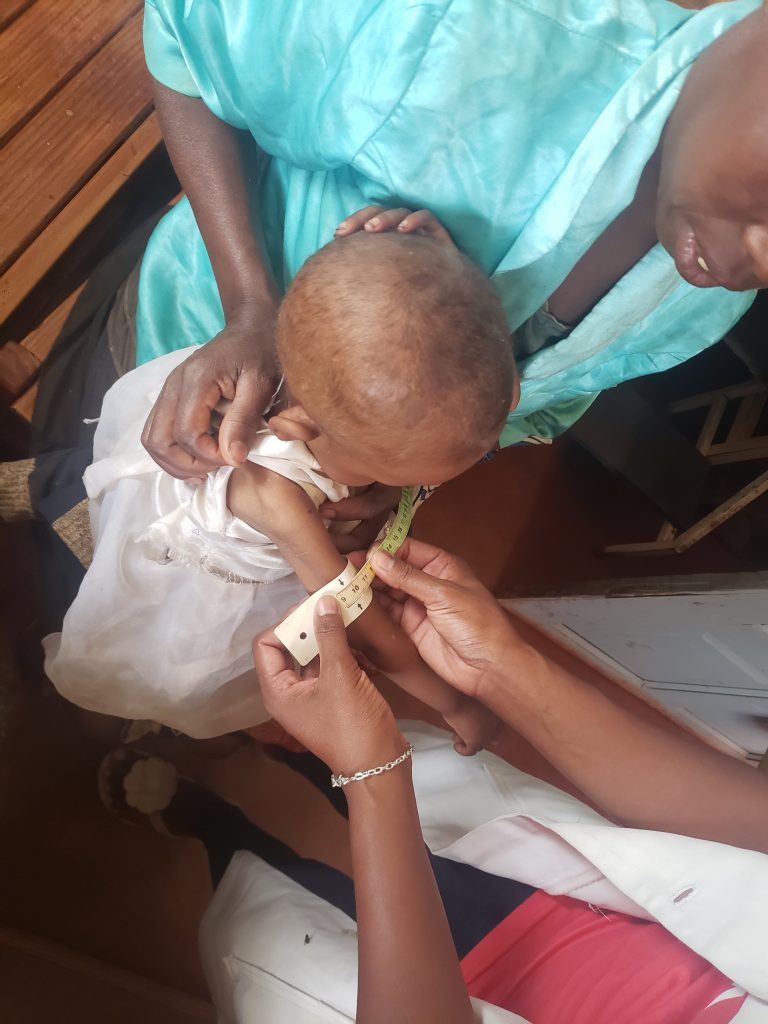 perimetre-brachial-malnutrition-solidarite-madagascar-enfance-sante